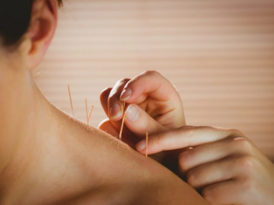 Sesion de Equilibrio y Sanación: Terapia de Acupuntura